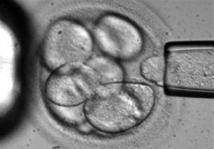 В США приступили к испытанию лечения эмбриональными клетками
