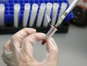 Чешские медики опасаются украинцев-вакцинофобов