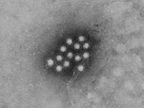17 жителей Львовской области госпитализированы с подозрением на гепатит