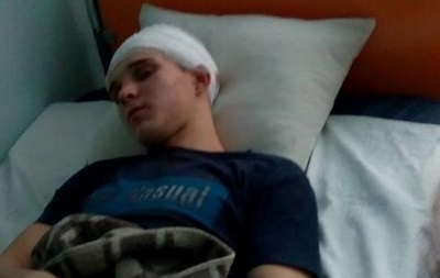 Под Киевом пять школьников избили сына чиновницы
