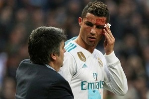 Реал показал страдания Роналду в раздевалке после полученного рассечения лица