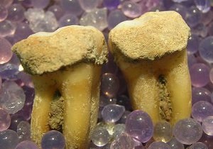 Рацион древних людей изучат по зубному камню