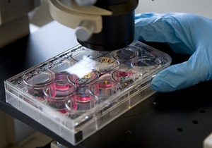 Новости науки - новости медицины: Один из белков иммунной системы помогает ВИЧ заражать клетки - ученые