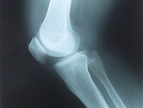 Снимок коленного сустава придет на смену отпечатку пальца