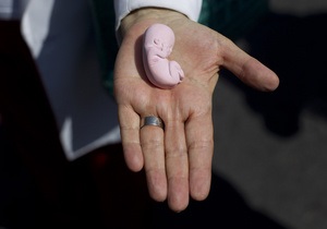 40 лет легализации абортов в США: раскол все глубже