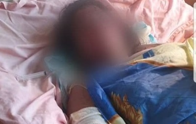 У Кривому Розі померла вагітна жінка, яку підпалив 17-річний співмешканець