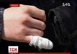 новости Киевской области - ГАИ - В Киевской области мужчина откусил кусок пальца инспектору ГАИ