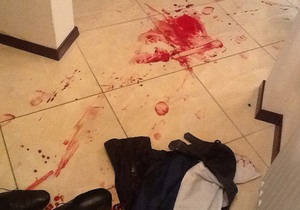 Батьківщина: На члена партии напали бандиты от Партии регионов с ножами