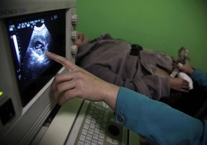 Рождение ребенка сняли на видео с помощью томографа