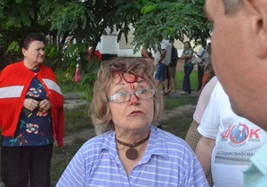 Скандальная стройка на Троещине: Возбуждено уголовное дело по факту нанесения травмы 71-летней активистке