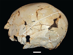Предки неандертальцев заботились об умственно отсталых - ученые