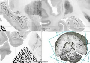 Ученые научились внедрять в мозг искусственные воспоминания