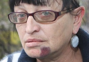 Аваков: Подонки, избившие активистку Батьківщини, не останутся безнаказанными