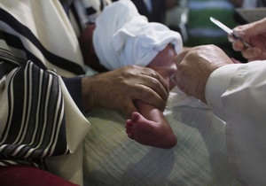 400 детей прошли массовое обрезание в Афганистане