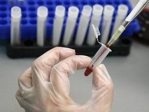 В двух харьковских колониях зеков проверят на ВИЧ