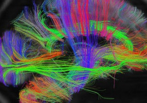 Ученые создали самую подробную карту мозга человека