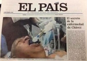 Фото Чавеса на операционном столе: автором поддельного снимка оказался известный итальянец