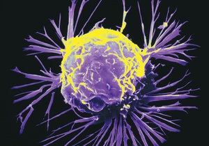 Ученые выяснили, как раковые клетки обманывают имунную систему
