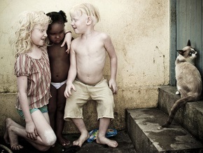 В семье темнокожих бразильцев родилось трое альбиносов