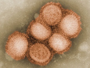 Начальник охраны президента Эквадора скончался от свиного грипа