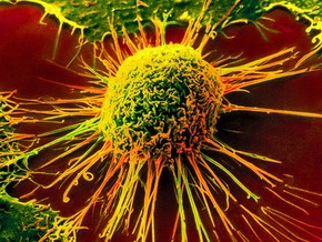 Американцы научились убивать раковые стволовые клетки