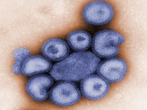 В Грузии зафиксирован первый случай заражения A/H1N1, в России – еще один