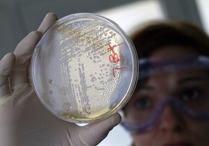 Ученые: Кишечные палочки E.coli пользуются  телеграфом 