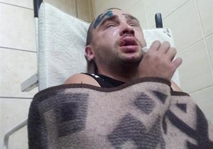 В Донецке неизвестные жестоко избили активиста Дорожного контроля