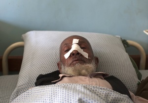 Мощный взрыв прогремел в военном госпитале Кабула