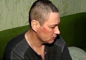 СМИ: В поисках Мазурка милиция избила инвалида-родственника его жены