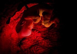 Британские ученые предложили новый способ обнаружения хромосомных дефектов у зародышей