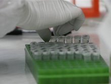 Ученые нашли уязвимое место вируса ВИЧ\СПИД