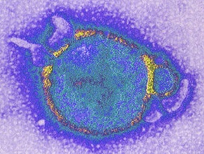 В Австралии ветеринар умер от редкого вируса