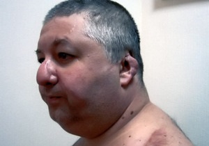 Депутату, которому отрезали нос и уши, дали 10 лет тюрьмы за покушение на Кернеса и Добкина