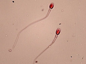 Ученые доказали влияние интеллекта на качество спермы