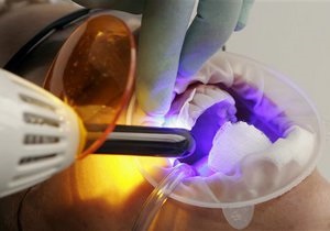 В Японии создали искуственную зубную эмаль