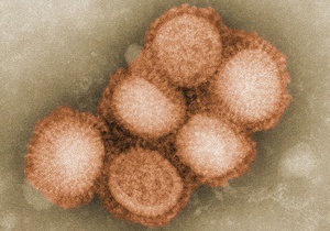 Вирус гриппа  А/H1N1 за неделю стал причиной смерти 412 человек в Европе