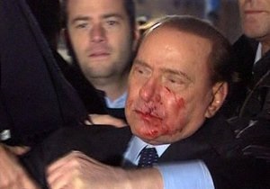 Путин похвалил Берлускони за мужественное поведение после нападения