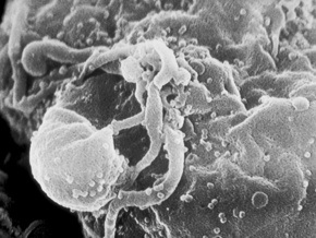 В организме человека нашли фермент, способный бороться с ВИЧ
