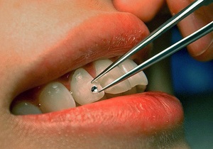 Международные праздники - Сегодня отмечается Международный день зубного врача