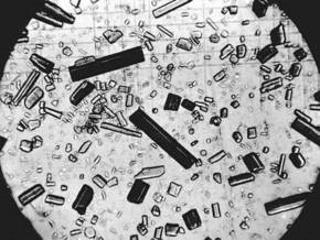 В США арестована депрессивная лаборантка, нарочно уничтожившая дорогие образцы