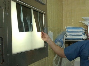 В Харьковской больнице скорой помощи появился новый рентгенаппарат