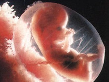 В животе девятилетней девочки нашли эмбрион