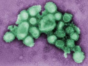 Эпидемиологи: миру надо смириться со свиным гриппом и лечить его