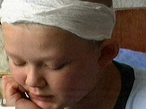 Экспертиза: Ребенка в Харьковской области ранил ученик военного лицея