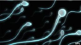 Ученые: Ультразвук останавливает сперматозоиды