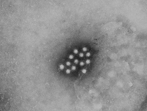 МЧС: Вспышка гепатита А в Одесской области остановлена