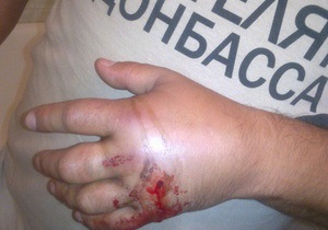 Міліція нічого не знає про поранення чоловіка у футболці Спасибі жителям Донбасу