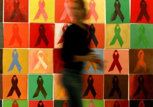 Российские ученые обнаружили новый подтип ВИЧ - спид
