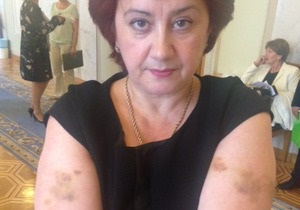 Батьківщина: Охорона Азарова побила народного депутата Ольгу Сікору
